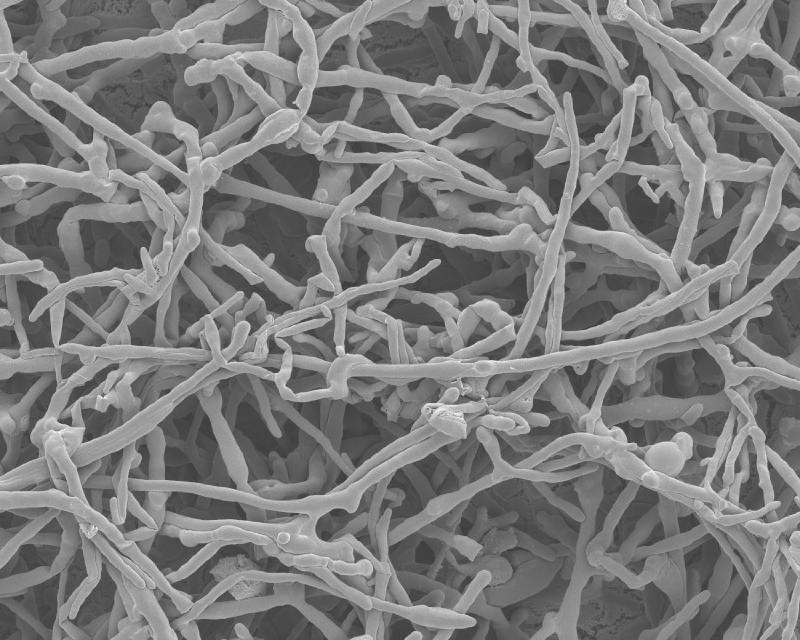 Bacterial protection of beetle-fungus mutualism.