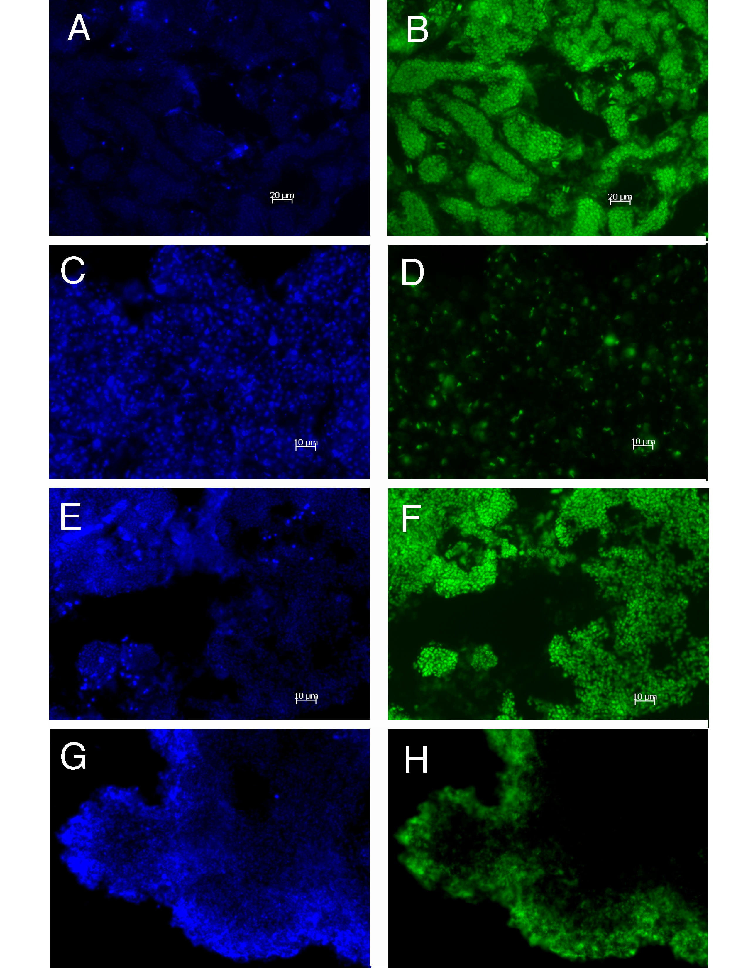CARD-FISH analysis of bacterial consortia from pink & purple berries of Sippewissett salt marsh (Cape Cod, MA). Left panels show DAPI stain & right panels show FITC labeled image. Results demonstrated distinct spatial patterns of distribution for different taxa. From my Microbial Diverity Course student project at the MBL.
